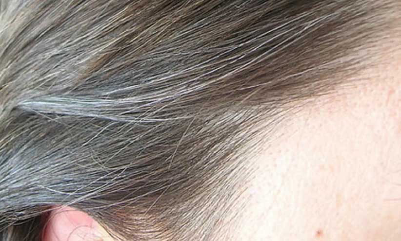 Lilis Christine, KLINIK VIKRIST : Mengatasi kebotakan, rambut rontok, ketombe dan uban dengan Akupunktur